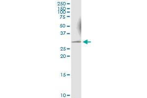 Immunoprecipitation of KHK transfected lysate using anti-KHK MaxPab rabbit polyclonal antibody and Protein A Magnetic Bead , and immunoblotted with KHK MaxPab mouse polyclonal antibody (B01) . (Ketohexokinase antibody  (AA 1-298))
