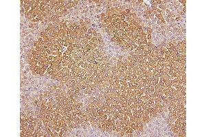 IHC analysis of CYP2E1 using anti-CYP2E1 antibody (ABIN7601446).