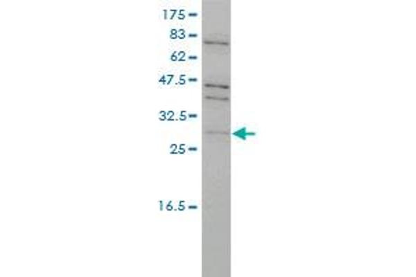 TP53RK anticorps  (AA 1-253)