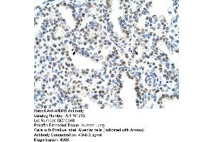 Rabbit Anti-WDR6 Antibody  Paraffin Embedded Tissue: Human Lung Cellular Data: Alveolar cells Antibody Concentration: 4. (WDR6 antibody  (C-Term))