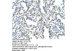 Rabbit Anti-WDR6 Antibody  Paraffin Embedded Tissue: Human Lung Cellular Data: Alveolar cells Antibody Concentration: 4. (WDR6 antibody  (C-Term))