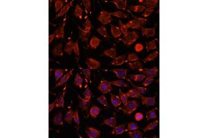 Immunofluorescence analysis of L929 cells using ITSN2 antibody (ABIN7268015) at dilution of 1:100. (Intersectin 2 antibody  (AA 500-620))