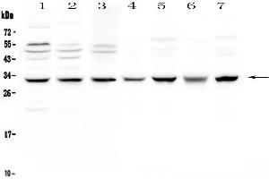 Western blot analysis of SDHB using anti-SDHB antibody . (SDHB antibody  (AA 29-280))