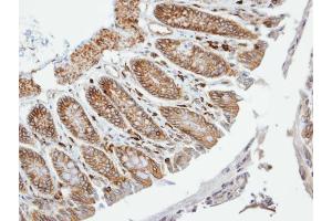 IHC-P Image Immunohistochemical analysis of paraffin-embedded human colon, using VAM1, antibody at 1:100 dilution. (MPP6 antibody  (N-Term))