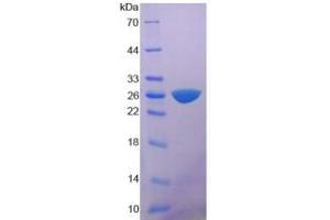SDS-PAGE analysis of Rat MYH6 Protein. (MYH6 Protein)