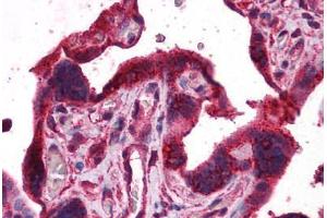 Human Placenta: Formalin-Fixed, Paraffin-Embedded (FFPE) (DPP8 antibody  (AA 1-39))