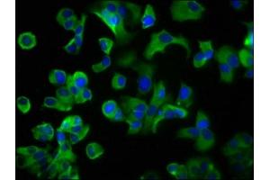 Immunofluorescence staining of MCF-7 cells with ABIN7158571 at 1:200, counter-stained with DAPI. (LRP2 antibody  (AA 202-332))