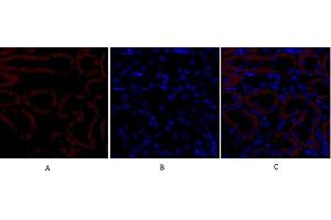 anti-Transforming Growth Factor, beta Receptor II (70/80kDa) (TGFBR2) (AA 60-140) antibody