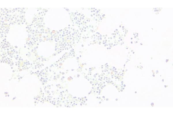 KLF1 antibody  (N-Term)