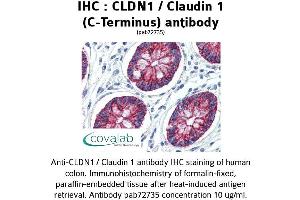Image no. 1 for anti-Claudin 1 (CLDN1) (C-Term) antibody (ABIN2852381) (Claudin 1 antibody  (C-Term))