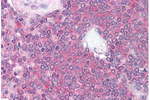 Human Spleen (formalin-fixed, paraffin-embedded) stained with MME antibody ABIN214166 at 1:100-1:200 followed by biotinylated anti-mouse IgG secondary antibody ABIN481714, alkaline phosphatase-streptavidin and chromogen. (CD101 antibody)