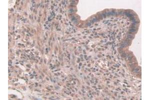 IHC-P analysis of Mouse Uterus Tissue, with DAB staining. (FAP antibody  (AA 542-761))
