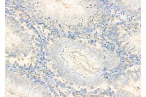 ABIN6261363 and ABIN6278853 at 1/100 staining Rat testis tissue by IHC-P.