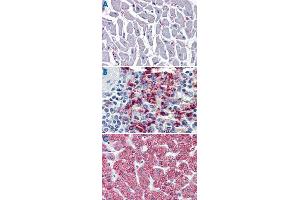 Immunohistochemistry (Formalin/PFA-fixed paraffin-embedded sections) of human heart (A), human spleen (B) and human liver tissue (C) tissue with CYSLTR2 polyclonal antibody . (CasLTR2 antibody  (N-Term))