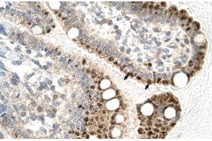 Human Intestine; Rabbit Anti-ZFP1 Antibody. (Zfp-1 antibody  (N-Term))