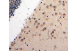 #VALUE! (ATR antibody  (AA 2353-2644))