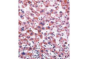CYP2C9 Antibody (N-term) ((ABIN392355 and ABIN2841994))immunohistochemistry analysis in formalin fixed and paraffin embedded human liver tissue followed by peroxidase conjugation of the secondary antibody and DAB staining. (CYP2C9 antibody  (N-Term))