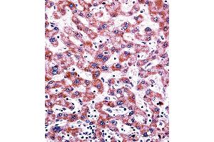 CYP2C9 Antibody (N-term) ((ABIN392355 and ABIN2841994))immunohistochemistry analysis in formalin fixed and paraffin embedded human liver tissue followed by peroxidase conjugation of the secondary antibody and DAB staining. (CYP2C9 antibody  (N-Term))