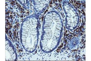 Immunohistochemical staining of paraffin-embedded Human colon tissue using anti-LRRC25 mouse monoclonal antibody.