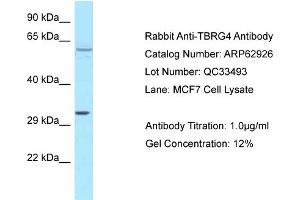 Western Blotting (WB) image for anti-Transforming Growth Factor beta Regulator 4 (TBRG4) (C-Term) antibody (ABIN971852) (TBRG4 antibody  (C-Term))