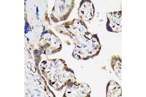 Immunohistochemistry of paraffin-embedded human placenta using LIN28B Rabbit mAb (ABIN7268267) at dilution of 1:100 (40x lens). (LIN28B antibody)