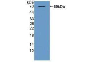 Detection of Recombinant TBP2, Mouse using Polyclonal Antibody to Thioredoxin-interacting Protein (TXNIP) (TXNIP antibody  (AA 30-381))