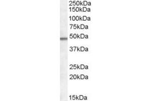 Western Blotting (WB) image for anti-Family with Sequence Similarity 188, Member B (FAM188B) (N-Term) antibody (ABIN2156837) (FAM188B antibody  (N-Term))