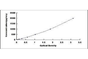 Typical standard curve (TNNI3 ELISA Kit)