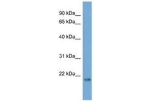 Image no. 1 for anti-Autophagy Related 12 (ATG12) (C-Term) antibody (ABIN6745680) (ATG12 antibody  (C-Term))