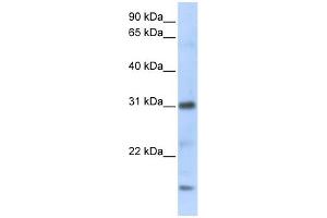WB Suggested Anti-CXCL16 Antibody Titration:  0. (CXCL16 antibody  (C-Term))