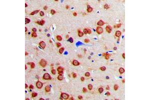 Immunohistochemical analysis of Calmodulin staining in human brain formalin fixed paraffin embedded tissue section. (Calmodulin 1 antibody  (Center))