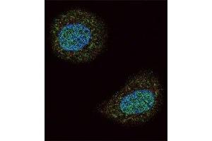 Confocal immunofluorescent analysis of PTEN antibody with MCF-7 cells followed by Alexa Fluor 488-conjugated goat anti-rabbit lgG (green). (PTEN antibody  (AA 69-104))