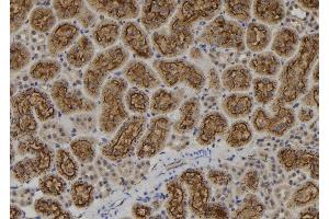 ABIN6276922 at 1/100 staining Rat kidney tissue by IHC-P. (IKZF1 antibody  (Internal Region))