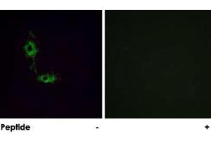 Immunofluorescence analysis of HeLa cells, using GRIA1 polyclonal antibody . (Glutamate Receptor 1 antibody)