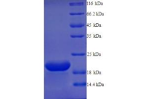 SDS-PAGE (SDS) image for G Protein-Coupled Receptor 75 (GPR75) (AA 372-540) protein (His tag) (ABIN5713482) (GPR75 Protein (AA 372-540) (His tag))