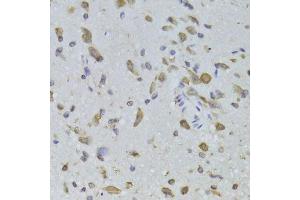 Immunohistochemistry (Paraffin-embedded Sections) (IHC (p)) image for anti-Ribosomal Protein L13 (RPL13) (AA 1-211) antibody (ABIN6147109)