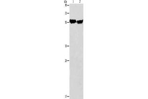 Gel: 8 % SDS-PAGE, Lysate: 40 μg, Lane 1-2: Mouse heart tissue, human fetal brain tissue, Primary antibody: ABIN7128507(ARHGEF9 Antibody) at dilution 1/950, Secondary antibody: Goat anti rabbit IgG at 1/8000 dilution, Exposure time: 5 seconds (Arhgef9 antibody)