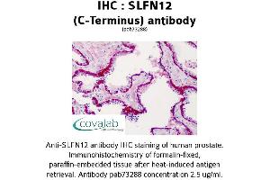 Image no. 1 for anti-Schlafen Family Member 12 (SLFN12) (C-Term) antibody (ABIN1739425) (SLFN12 antibody  (C-Term))