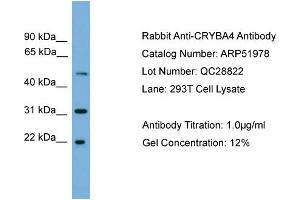 WB Suggested Anti-CRYBA4  Antibody Titration: 0. (CRYbA4 antibody  (Middle Region))