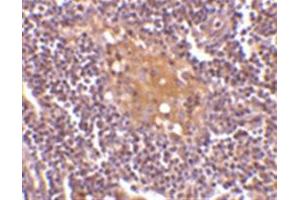 Image no. 2 for anti-CD5 Molecule-Like (CD5L) (C-Term) antibody (ABIN318735) (CD5L antibody  (C-Term))