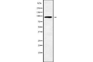 Western blot analysis of RHG12 using Jurkat whole cell lysates (ARHGAP12 antibody  (Internal Region))