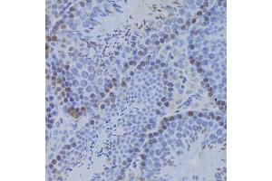 Immunohistochemistry of paraffin-embedded mouse testis using JMJD6 Antibody (ABIN5973452) at dilution of 1/100 (40x lens). (JMJD6 antibody)