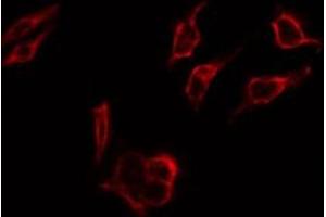 ABIN6267274 staining 293 by IF/ICC. (Estrogen Receptor alpha antibody  (pSer167))