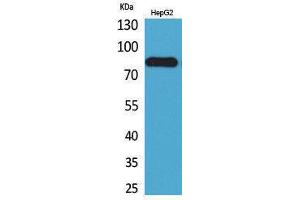 Western Blotting (WB) image for anti-CD248 Molecule, Endosialin (CD248) (Internal Region) antibody (ABIN3178297) (CD248 antibody  (Internal Region))