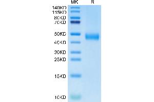 Biotinylated Human CD38 on Tris-Bis PAGE under reduced condition. (CD38 Protein (AA 43-300) (His-Avi Tag,Biotin))
