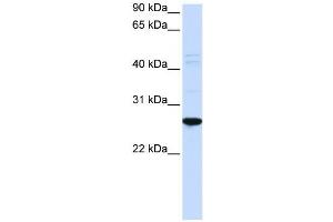 Western Blotting (WB) image for anti-Dorsal Root Ganglia Homeobox (DRGX) antibody (ABIN2459124)