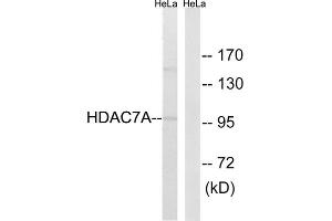 Western blot analysis of extracts from HeLa cells, using HDAC7A (epitope around residue 155) antibody. (HDAC7 antibody  (Ser155))