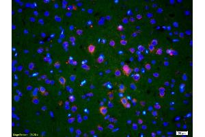 Formalin-fixed and paraffin-embedded rat brain labeled with Anti-Endo G Polyclonal Antibody, Unconjugated (ABIN680893) 1:200, overnight at 4°C, The secondary antibody was Goat Anti-Rabbit IgG, Cy3 conjugated used at 1:200 dilution for 40 minutes at 37°C. (Endonuclease G antibody  (AA 101-200))