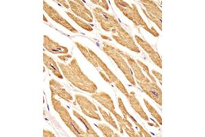 Antibody staining VLDLR in human heart tissue sections by Immunohistochemistry (IHC-P - paraformaldehyde-fixed, paraffin-embedded sections). (Very Low Density Lipoprotein (VLDL) (AA 484-510) antibody)