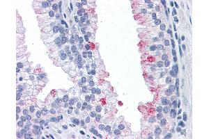 Anti-RTKN antibody IHC of human prostate. (Rhotekin antibody  (AA 451-550))